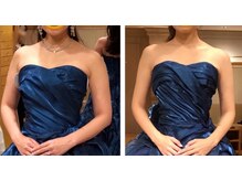 ローズボディ 恵比寿店/小顔＆二の腕矯正で脇肉スッキリ