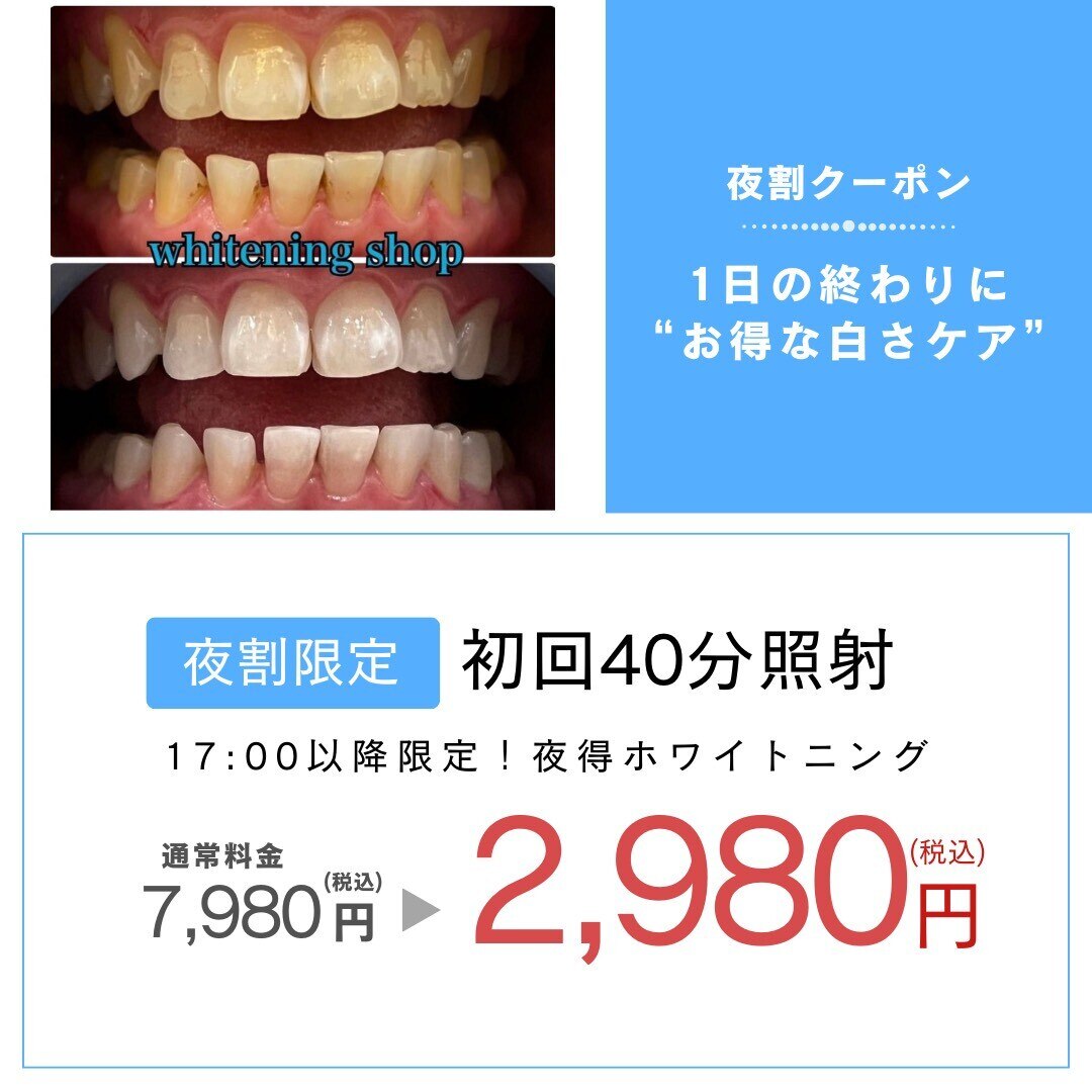 【医療提携】ホワイトニングメニュー導入　単品可 医療提携】ホワイトニングメニュー導入 単品可