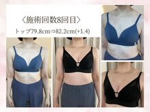 バスト鍼ラボ 代々木上原(BUST 鍼LAB.)の雰囲気（施術8回目のお客様お悩み:サイズアップ、左右差の改善）
