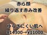 【赤ら顔・繰り返す赤み改善】ゆらぎにくい肌へ肌育ハーブピーリング
