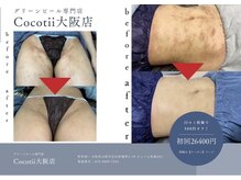 ココティー 大阪店(Cocotii)の雰囲気(グリーンピール全国大会2022 2024 2025年ボディ部門グランプリ)