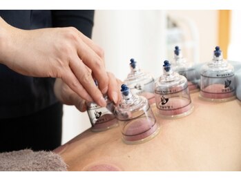 メディカルエステティックサロン サロンド ハリス ヤゴト(Salon'de HALLIS yagoto)の写真/カッピング×リンパマッサージ×揉みほぐしで肩こり、全身の疲れをケア。