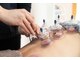 メディカルエステティックサロン サロンド ハリス ヤゴト(Salon'de HALLIS yagoto)の写真/カッピング×リンパマッサージ×揉みほぐしで肩こり、全身の疲れをケア。