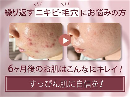 ルナティアラ(LUNAティアラ)の写真