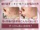 ルナティアラ(LUNAティアラ)の写真