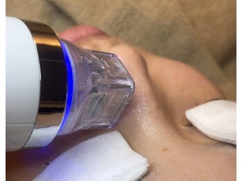 アイスリー(i III)の写真/【人気NO.1★洗浄だけで終わらない】PDRN×フラクショナルRFで毛穴開きまで徹底ケア！