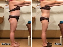 ノタメ(notame)の雰囲気（痩身機キャビテーション＋骨盤矯正でダイエット☆【福岡市南区】）