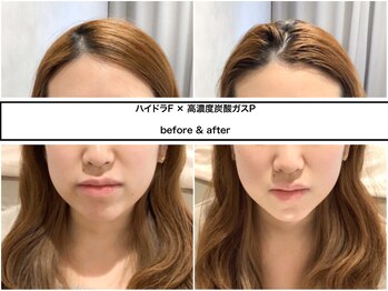 ディアメ(Diame)/美肌作り