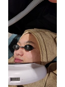 ラデュープラス(Radieux+)/男性限定 美肌プログラム