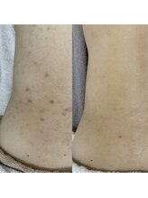 シェノン 赤坂大濠店/