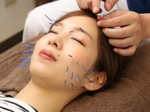 ライフサロン 恵比寿(Life Salon)/頭皮から電磁パルスで引き上げ