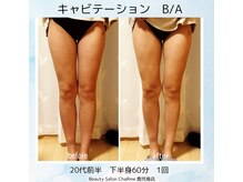 シャルム 鹿児島店(ChaRme)/キャビテーション１回