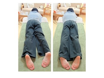 ルミナフローム(LuminaFlowm)/ビフォーアフター