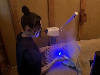 装910の写真/【人気No.1◎】顔脱毛×毛穴洗浄初回限定!通常価格¥8800→¥4900ヘッドマッサージ付き♪