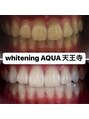 アクア 天王寺店(AQUA) ホワイトニング/ホワイトニング専門店/天王寺/ホワイトニング
