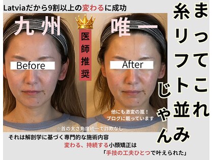 ラトビア(Latvia)の写真