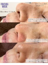 ドラセナ トータルビューティー(Dracaena Total Beauty)/鼻な黒ずみも撃退!!