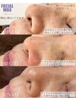 ドラセナ トータルビューティー(Dracaena Total Beauty)/鼻な黒ずみも撃退!!