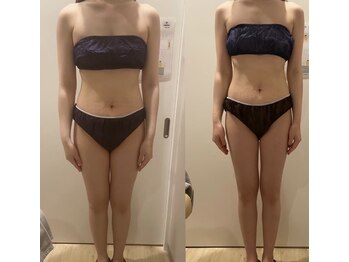 ナトゥーラ(NatuLa)/ボディメイクBefore&After