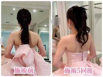 美容整体LUNOA　神戸三宮院/ブライダル整体