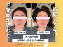 ルルラボ(LuLu beauty labo)/中顔面が整うと輪郭スッキリ