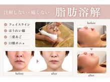 トロワ(TROIS)の雰囲気（結果重視☆専門知識を有するスタッフの信頼の施術！長野市/小顔）