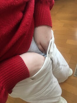アロハウス(ALOHOUSE)の写真/【耳つぼ+生活習慣カウンセリング】で無理なく結果出し!「とにかくお腹が痩せたい…」そんな方にイチオシ
