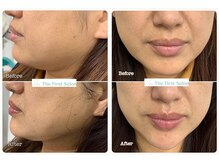 ザ ファーストサロン(The First Salon)/複数の機械&施術の組み合わせ