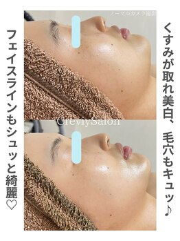 クレヴィー(Creviy)/陶肌トリートメント1回の変化
