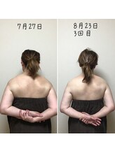 アルディート(Ardito)/肩甲骨剥がし