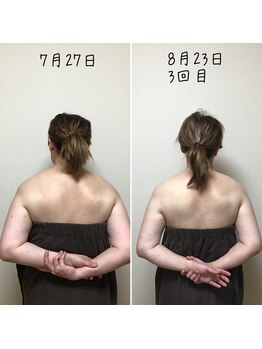 アルディート(Ardito)/肩甲骨剥がし