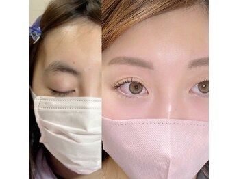 ユウワ(yuwa)/垢抜けNO,1メニュー