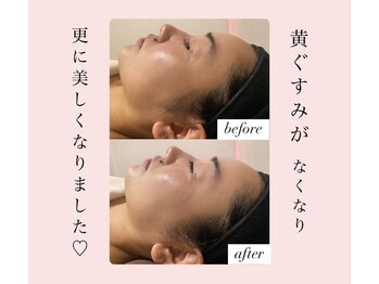 ディサイドロー(DECIDE L.A.W)/更に美しく！