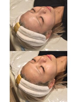 アディクト(Addict)/Before＆After