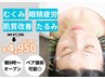 美容鍼人気No.1【ヘッドスパ無料！？】 スタンダードコース ¥7700→¥4950