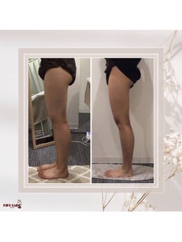 効くラボ 梅田店/月3回来店！下半身集中痩せ★