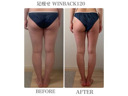 イリゼ(IRISER)の写真