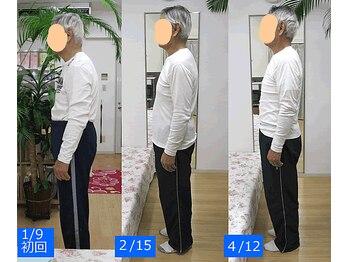 エスコート芦屋サロン/60代 男性 猫背 首の不調