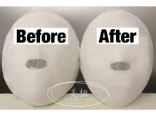 美極 トータルビューティー(美極 TOTAL BEAUTY)/恵比寿/小顔コルギ/エステ/