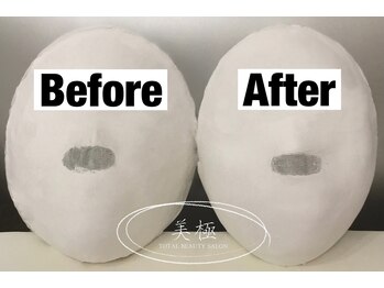 美極 トータルビューティー(美極 TOTAL BEAUTY)/恵比寿/小顔コルギ/エステ/