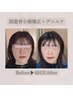 【No. 1☆マスクを堂々と外す】頭蓋骨小顔＋毛穴肌質改善/¥15400→¥7800