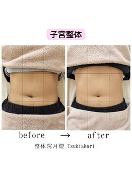 整体院 月燈/お客様写真