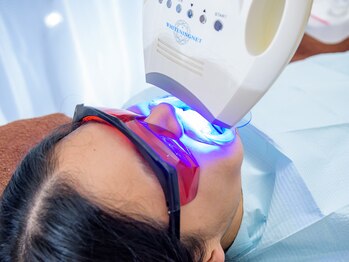 サロンドボンシャンス(salon de bonne chance)/セルフホワイトニング手順12