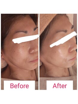 エステティックサロン やまとなでしこ/フェイシャル☆ACトリートメント