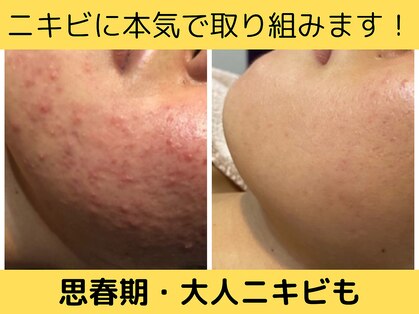 チャロアイト 可部店(Charoite)の写真