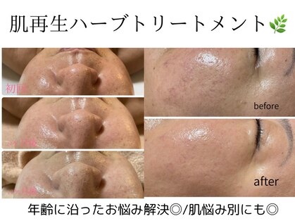 グロウ バイ フェイシャルデザイン アンド アイ(GROW)の写真