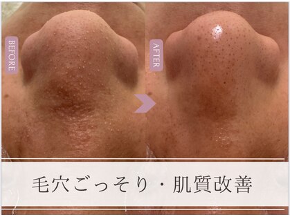 カノア(CANOA)の写真