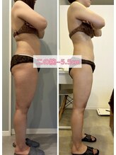 サロン ド フェイス モアナ(Salon de Faith Moana)/キャビテーション痩身【20代】