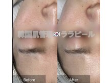 リツイート(ReTweet)/ララピール艶肌・美白・くすみ