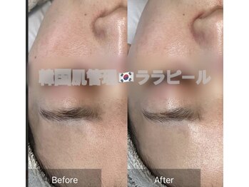 リツイート(ReTweet)/ララピール艶肌・美白・くすみ